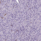 Immunohistochemical staining of human pancreas shows no positivity in exocrine glandular cells as expected.