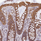 Immunohistochemical staining of human colon shows strong cytoplasmic positivity in glandular cells.