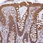 Immunohistochemical staining of human colon shows strong cytoplasmic positivity in glandular cells.