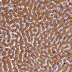 Immunohistochemical staining of human liver shows strong cytoplasmic positivity in hepatocytes.