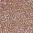 Immunohistochemical staining of human liver shows strong cytoplasmic positivity in hepatocytes.
