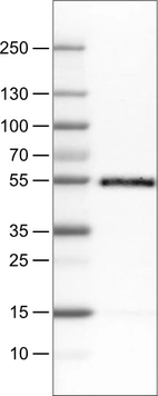 Lane 1: Marker [kDa]_br/_Lane 2: Human tonsil tissue lysate