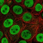 Immunofluorescent staining of human cell line MCF7 shows localization to nucleoplasm & nucleoli fibrillar center.