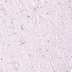 Immunohistochemical staining of human skeletal muscle shows no positivity in myocytes as expected.