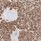 Immunohistochemical staining of human pancreas shows strong cytoplasmic positivity in exocrine glandular cells.