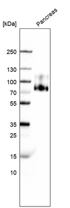 Western blot analysis in human pancreas tissue.