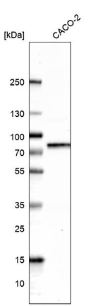 Anti-DCP1A Antibody