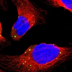 Immunofluorescent staining of human cell line U-2 OS shows localization to cytoplasmic bodies.