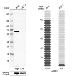 Western blot analysis in human cell lines RT-4 and MCF-7 using Anti-ABCD3 antibody. Corresponding ABCD3 RNA-seq data are presented for the same cell lines. Loading control: Anti-GAPDH.