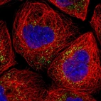 Immunofluorescent staining of human cell line A-431 shows localization to peroxisomes.