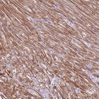 Immunohistochemical staining of human heart muscle shows moderate cytoplasmic positivity in cardiomyocytes.