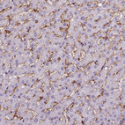 Anti-CD14 Antibody