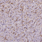 Immunohistochemical staining of human liver shows moderate membranous positivity in Kupffer cells.