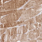 Immunohistochemical staining of human skeletal muscle shows moderate cytoplasmic positivity in myocytes.