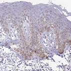 Immunohistochemical staining of human skin shows weak cytoplasmic positivity in squamous epithelial cells.