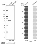 Western blot analysis in human cell lines U2OS and U-251MG using Anti-VRK2 antibody. Corresponding VRK2 RNA-seq data are presented for the same cell lines. Loading control: Anti-GAPDH.
