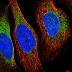 Immunofluorescent staining of human cell line U-2 OS shows positivity in endoplasmic reticulum.