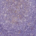 Anti-CD14 Antibody