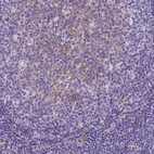 Immunohistochemical staining of human tonsil shows moderate membranous positivity, mainly in germinal center cells.