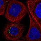 Immunofluorescent staining of human cell line A-431 shows localization to vesicles.
