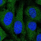Immunofluorescent staining of human cell line U-2 OS shows localization to cytosol.