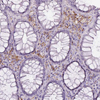 Immunohistochemical staining of human rectum shows moderate membranous positivity in lymphoid cells.