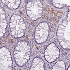 Immunohistochemical staining of human rectum shows moderate membranous positivity in lymphoid cells.