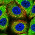 Immunofluorescent staining of human cell line MCF7 shows localization to cytosol.