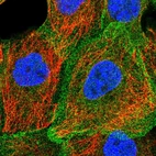 Immunofluorescent staining of human cell line A-431 shows localization to plasma membrane.