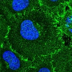 Immunofluorescent staining of human cell line HeLa shows localization to plasma membrane.