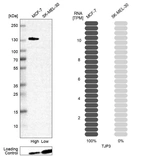 Western blot analysis in human cell lines MCF-7 and SK-MEL-30 using Anti-TJP3 antibody. Corresponding TJP3 RNA-seq data are presented for the same cell lines. Loading control: Anti-PFN1.