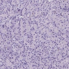 Immunohistochemical staining of human pancreas shows no positivity in exocrine glandular cells as expected.
