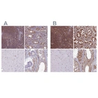 Immunohistochemistry analysis in human rectum and skeletal muscle tissues using HPA050327 antibody. Corresponding PSMB8 RNA-seq data are presented for the same tissues.