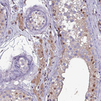 Immunohistochemical staining of human rectum shows strong cytoplasmic-nucleus positivity in glandular cells and lymphoid cells.