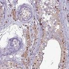 Immunohistochemical staining of human rectum shows strong cytoplasmic-nucleus positivity in glandular cells and lymphoid cells.