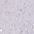 Immunohistochemical staining of human skeletal muscle shows negative positivity in myocytes as expected.