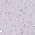 Immunohistochemical staining of human skeletal muscle shows negative positivity in myocytes as expected.