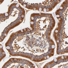 Anti-RPL27 Antibody