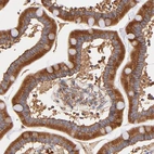Immunohistochemical staining of human duodenum shows strong cytoplasmic positivity in glandular cells.