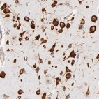 Immunohistochemical staining of human cerebral cortex shows strong cytoplasmic positivity in neurons.
