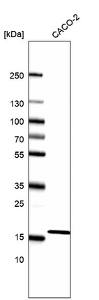 Western blot analysis in human cell line CACO-2.