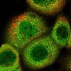 Immunofluorescent staining of human cell line A-431 shows localization to nucleoplasm & cytosol.