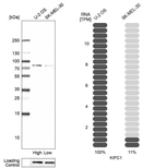 Western blot analysis in human cell lines U2OS and SK-MEL-30 using Anti-KIFC1 antibody. Corresponding KIFC1 RNA-seq data are presented for the same cell lines. Loading control: Anti-COX4I1.