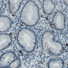 Immunohistochemical staining of human stomach shows strong positivity in a subset of lymphoid cells.