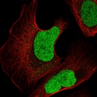 Immunofluorescent staining of human cell line U-2 OS shows localization to nucleoplasm.