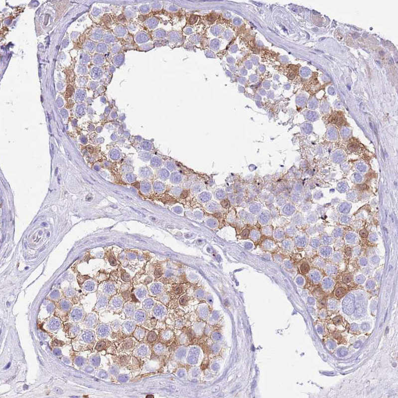 Rabbit Polyclonal Anti-EFHD2 Antibody - Buy for research - Highly ...