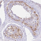 Immunohistochemical staining of human testis shows moderate cytoplasmic positivity in cells in seminiferous ducts.