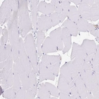 Immunohistochemical staining of human skeletal muscle shows no positivity in myocytes as expected.