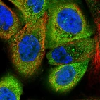 Immunofluorescent staining of human cell line A-431 shows localization to cytosol.