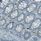 Immunohistochemical staining of human colon shows strong immunoreactivity in a subset of lymphoid cells.